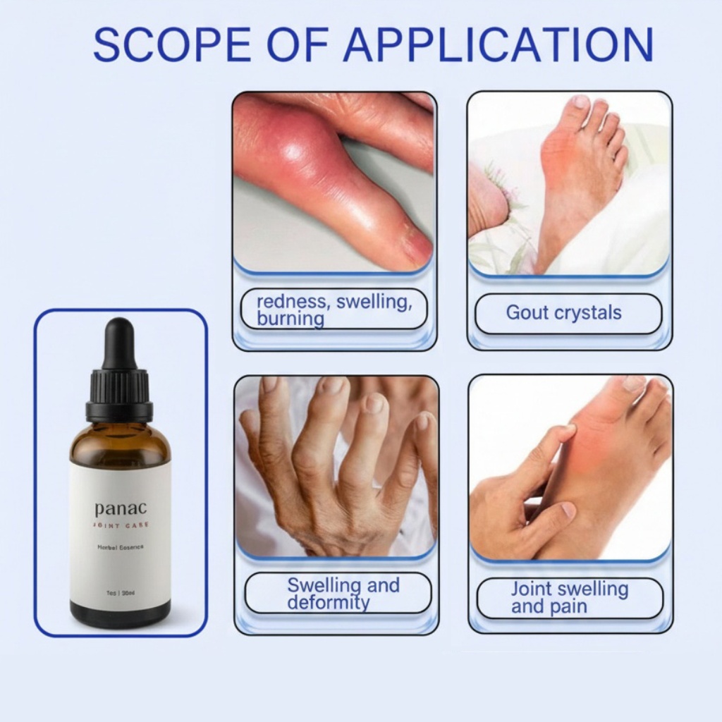 Scope of application - 4 joint conditions